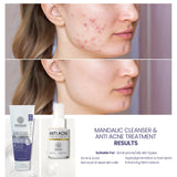 Mandelic Cleanser & Anti Acne Treatment